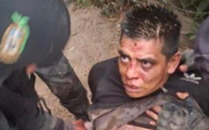 Le amputan la pierna a exfugado tras enfrentamiento en Ostuncalco